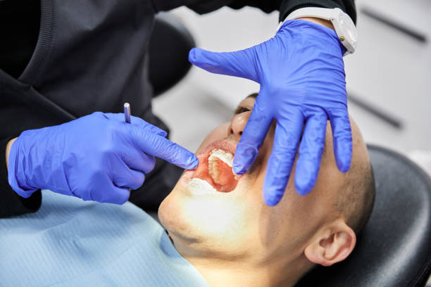 Best Teeth Whitening  in Valdese, NC